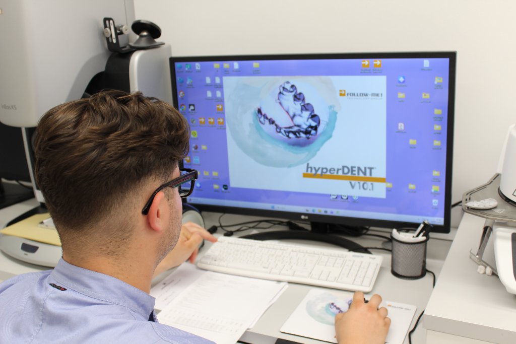 Fase CAM con software HyperDENT