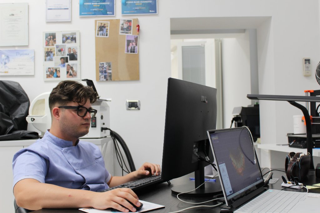 Postazione CAD per progettazione odontotecnica nel laboratorio Torraco Protesi